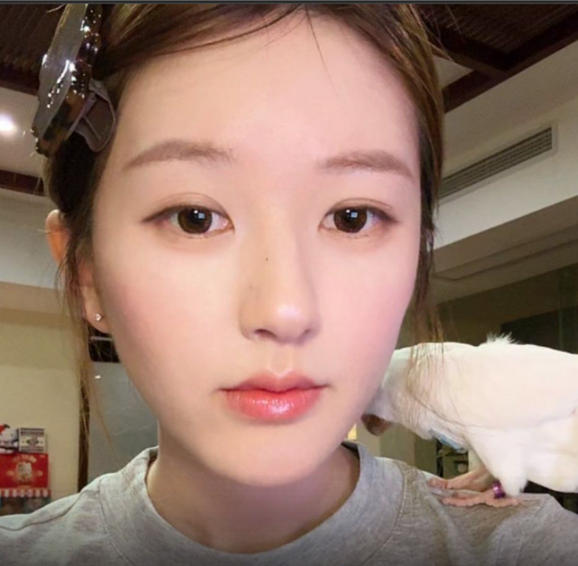 จ้าวลู่ซือ เปิดใจมรสุมป่วยผิวหนังลอกเกือบเสียสติ