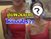 เห็นแล้วแห่เป็นห่วง เธอคนนี้ซูบผอม-ตาเหลือง ป่วย2โรคนี้