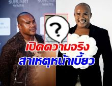 รัศมีแข เปิดภาพล่าสุด ใบหน้าเบี้ยว จนอดเป็นห่วงไม่ได้