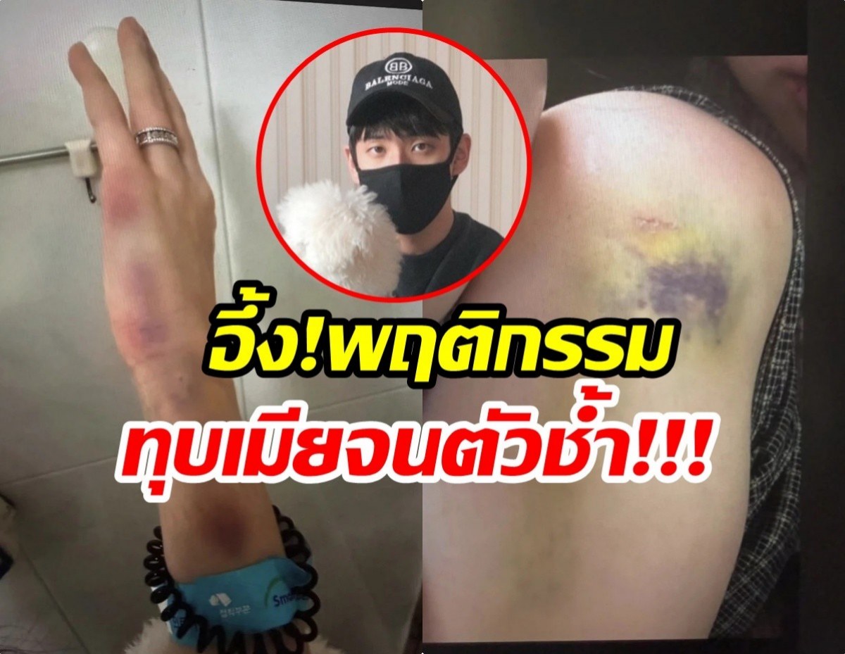 จับตาดราม่าร้อน พี่ชายซุปตาร์สาว ถูกเเฉทุบตีเมีย