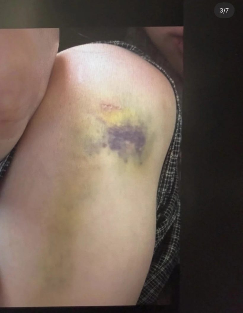 จับตาดราม่าร้อน พี่ชายซุปตาร์สาว ถูกเเฉทุบตีเมีย