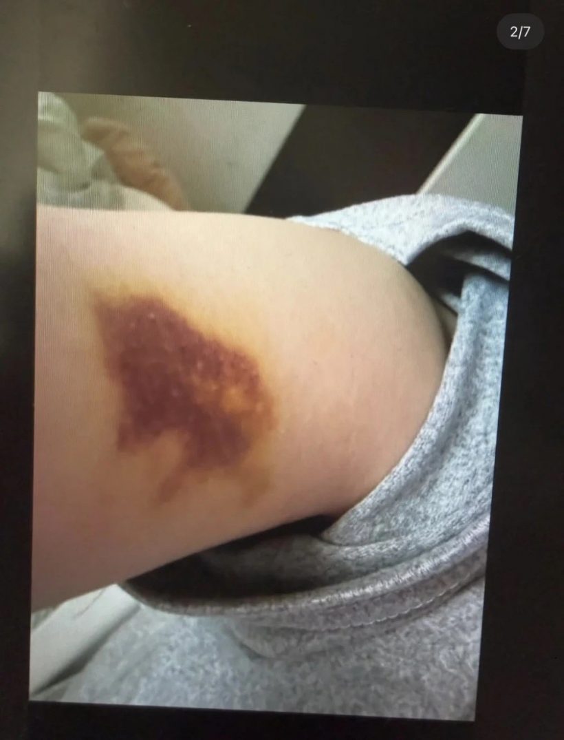 จับตาดราม่าร้อน พี่ชายซุปตาร์สาว ถูกเเฉทุบตีเมีย