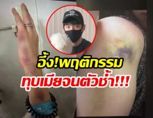 จับตาดราม่าร้อน พี่ชายซุปตาร์สาว ถูกเเฉทุบตีเมีย