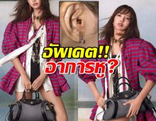 ลิซ่า อัปเดตอาการบาดเจ็บหลังเลือดไหลจากรูหู จนแฟนๆเป็นห่วง