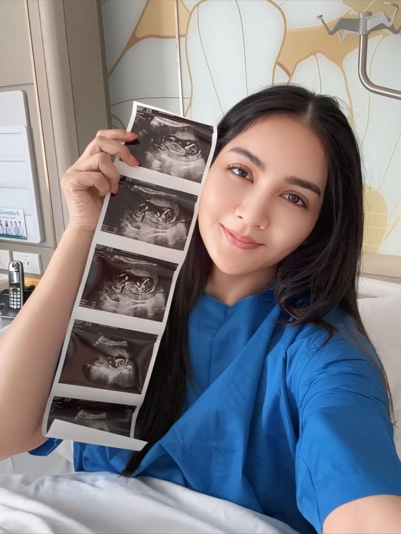 ครูก้อย เผยสาเหตุเย็บปากมดลูก ขณะตั้งครรภ์ลูกคนที่2