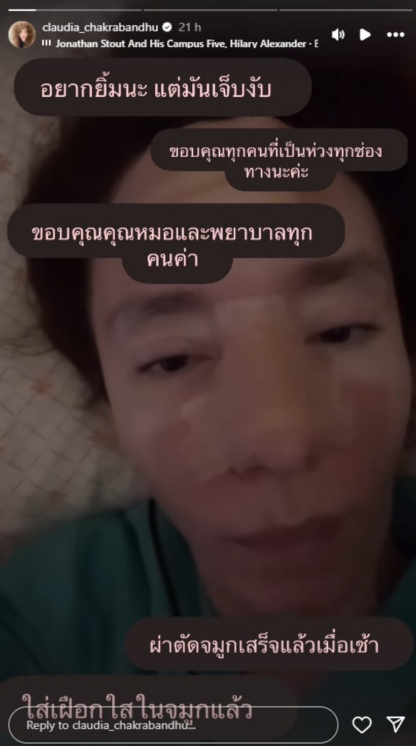 ภาพล่าสุด คลาวเดีย จักรพันธุ์ หลังวูบหัวฟาด ต้องใส่เฝือกจมูก