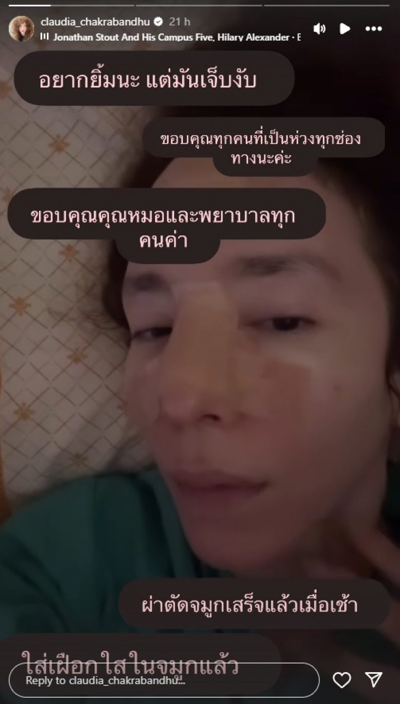 ภาพล่าสุด คลาวเดีย จักรพันธุ์ หลังวูบหัวฟาด ต้องใส่เฝือกจมูก