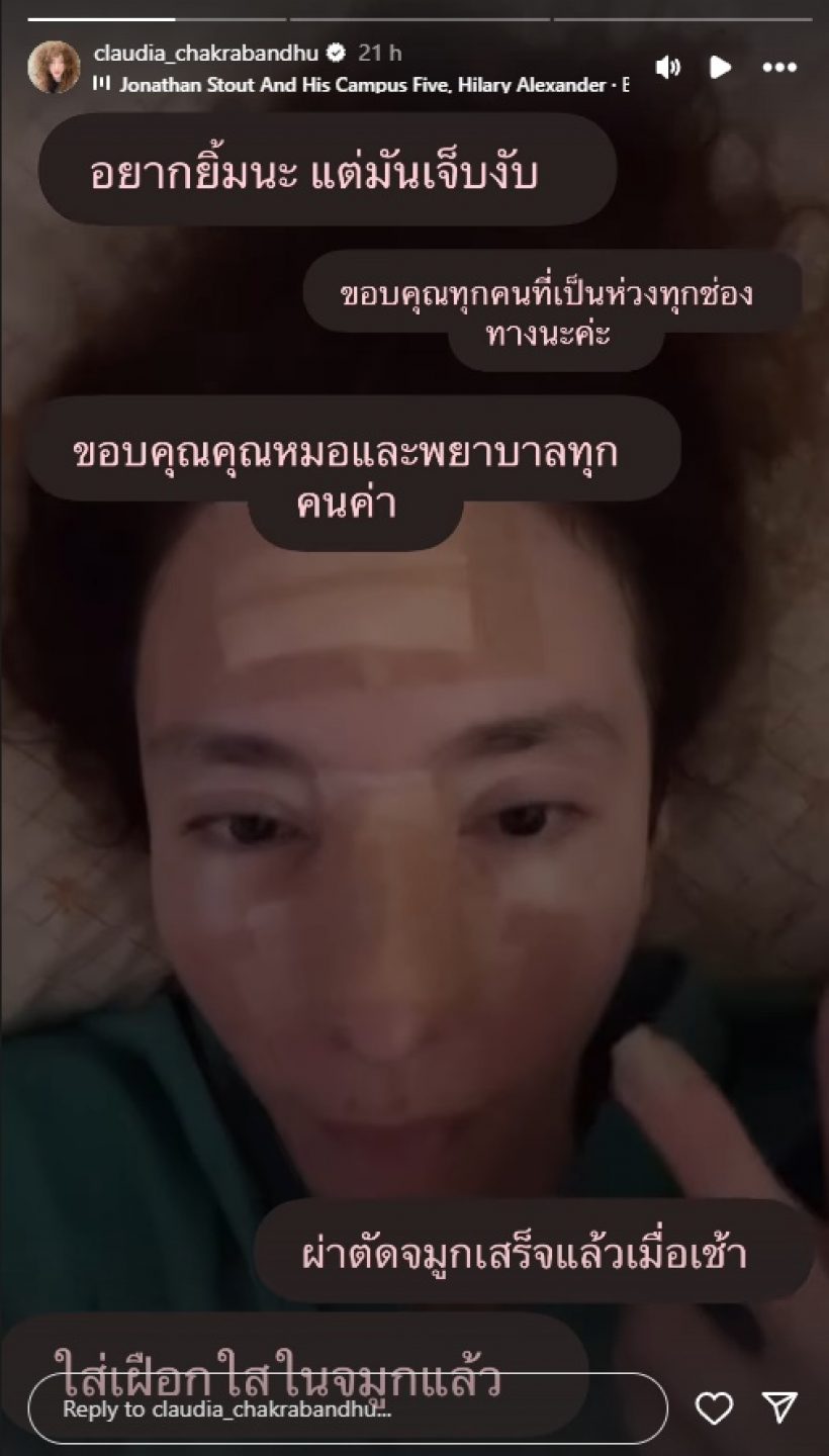 ภาพล่าสุด คลาวเดีย จักรพันธุ์ หลังวูบหัวฟาด ต้องใส่เฝือกจมูก
