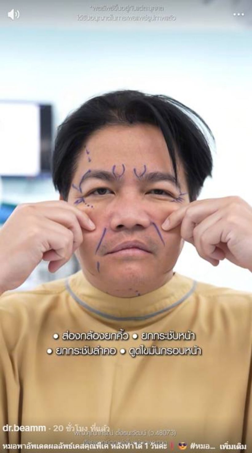 มิเรียน อัปเดทหน้าใหม่ พีเค โดนคนแซะขนาดนี้จะฟ้องไหม?