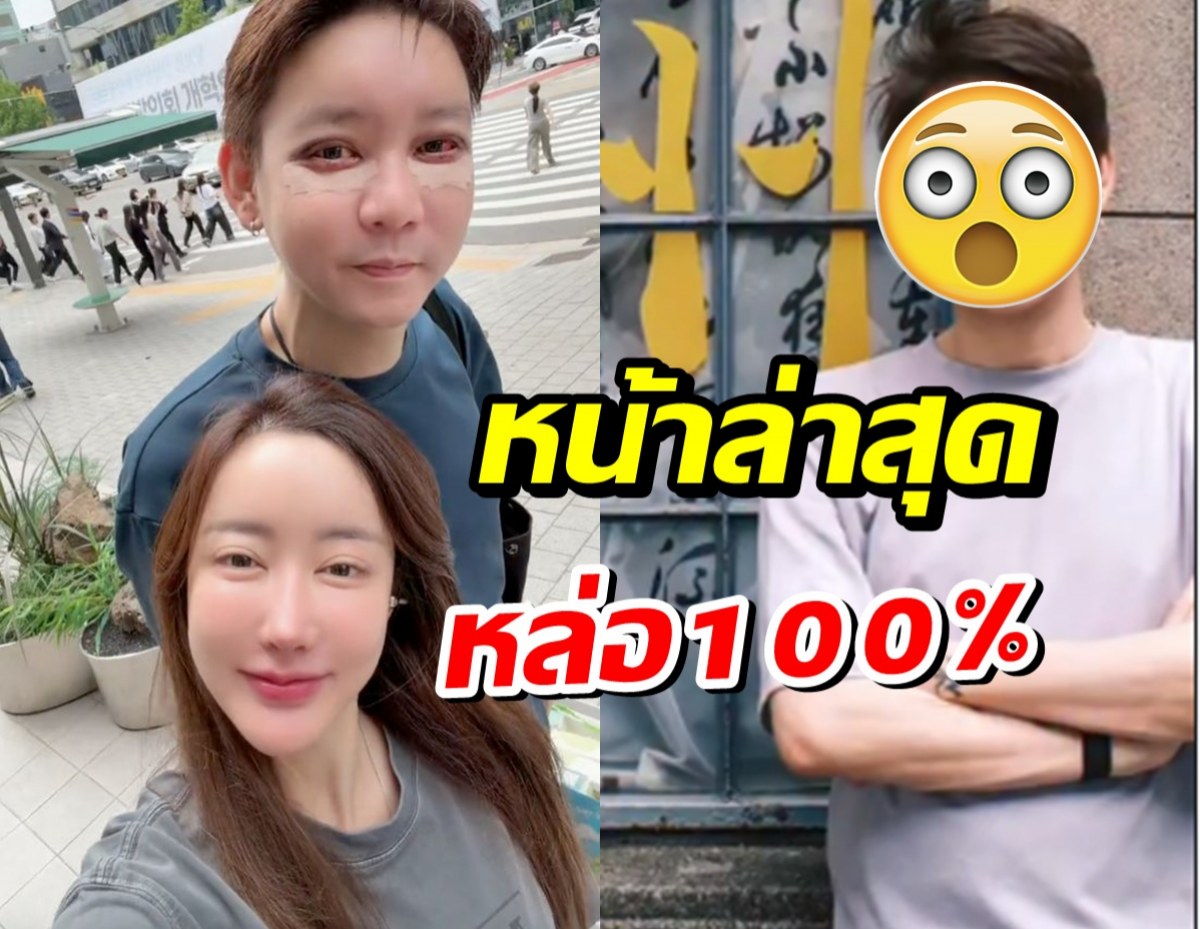 ขยี้ตาเเทบหลุด! นี่คือหน้าล่าสุดของ จิน ธรรมวัฒนะ