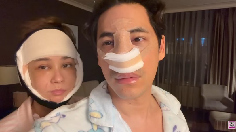 เปิดโฉม ซี-เอมี่ หลังอัปหน้าใหม่ เปลี่ยนไปขนาดไหน