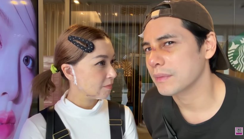 เปิดโฉม ซี-เอมี่ หลังอัปหน้าใหม่ เปลี่ยนไปขนาดไหน