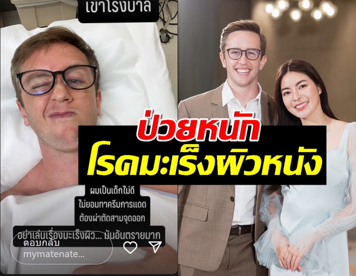 ส่งกำลังใจ! เนท My Mate Nate แจ้งข่าวป่วยมะเร็งผิวหนัง ต้องผ่าตัด
