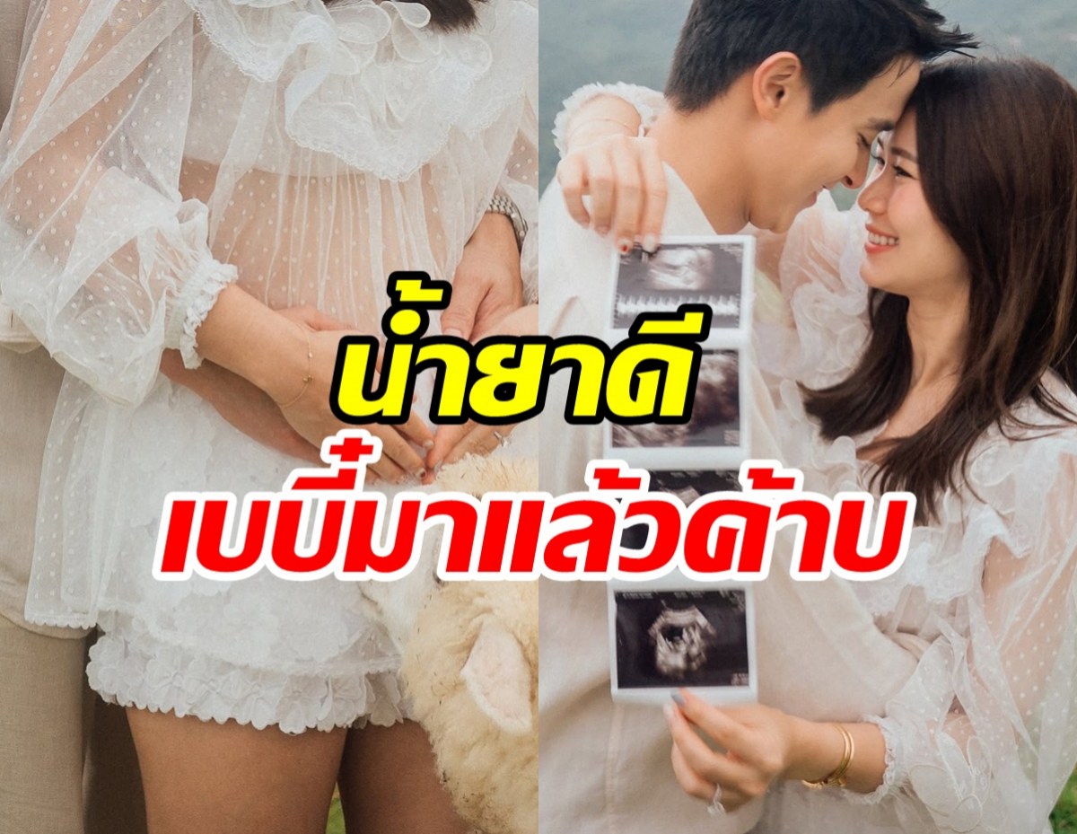 ยินดีทั้งประเทศ! เจมส์ จิรายุ เตรียมเป็นคุณพ่อแล้ว