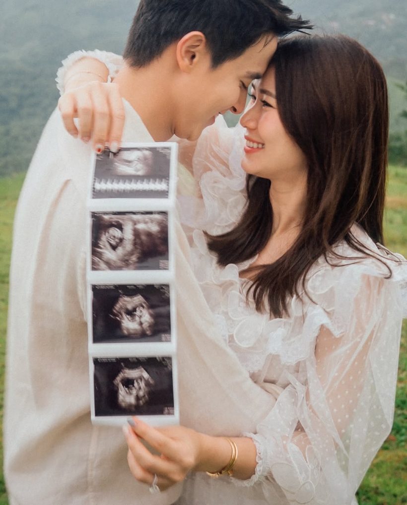 ยินดีทั้งประเทศ! เจมส์ จิรายุ เตรียมเป็นคุณพ่อแล้ว
