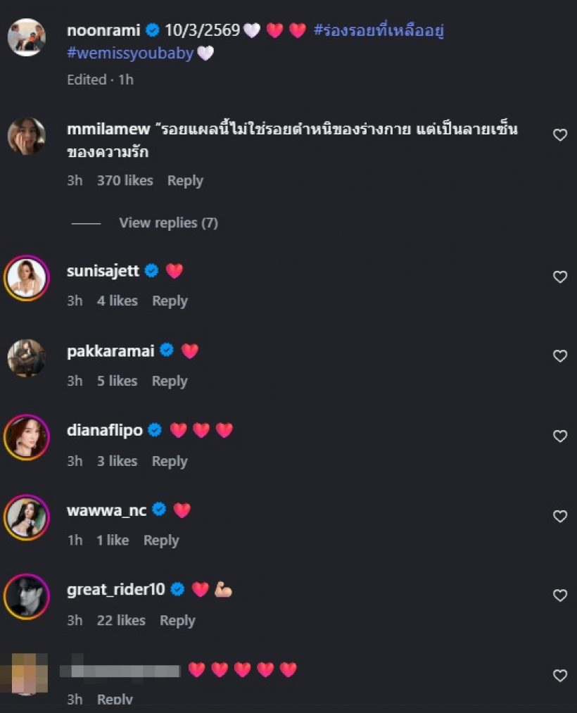 นุ่น รมิดา เปิดรอยแผลที่ท้อง เจอชาวเน็ตคอมเมนต์ซึ้งมาก