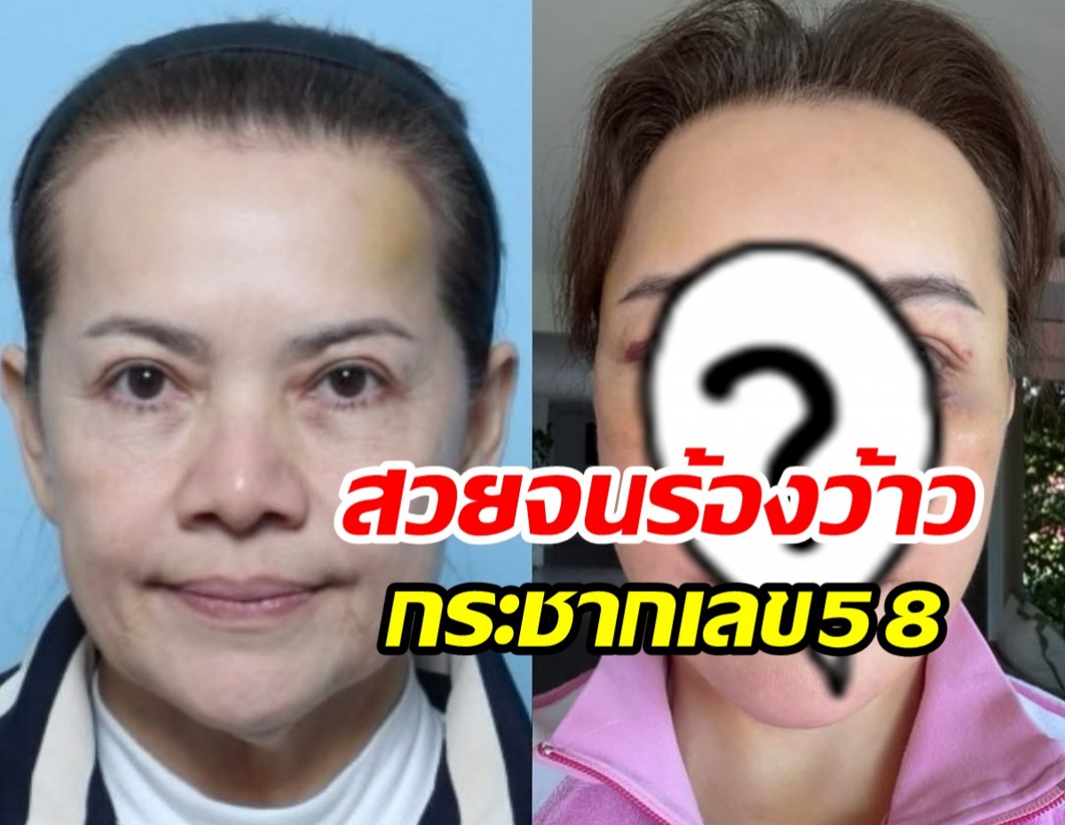 สวยขึ้นทันตา! หนูแหม่ม สุริวิภา อัปหน้าใหม่ปังยิ่งกว่าเดิม