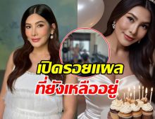 นุ่น รมิดา เปิดรอยแผลที่ท้อง เจอชาวเน็ตคอมเมนต์ซึ้งมาก