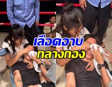 พระเอกดัง พลาดท่าผิดคิว จนเลือดอาบกลางกองถ่าย