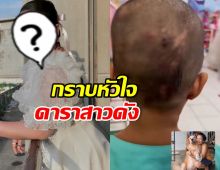 คนสวยใจบุญ ดาราสาวดัง ยื่นมือซัพพอร์ตเด็กศีรษะเป็นหนอง