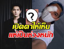 ใจหายวาบ! เข้ม หัสวีร์ เปิดภาพเผยสาเหตุ ต้องปิดตา