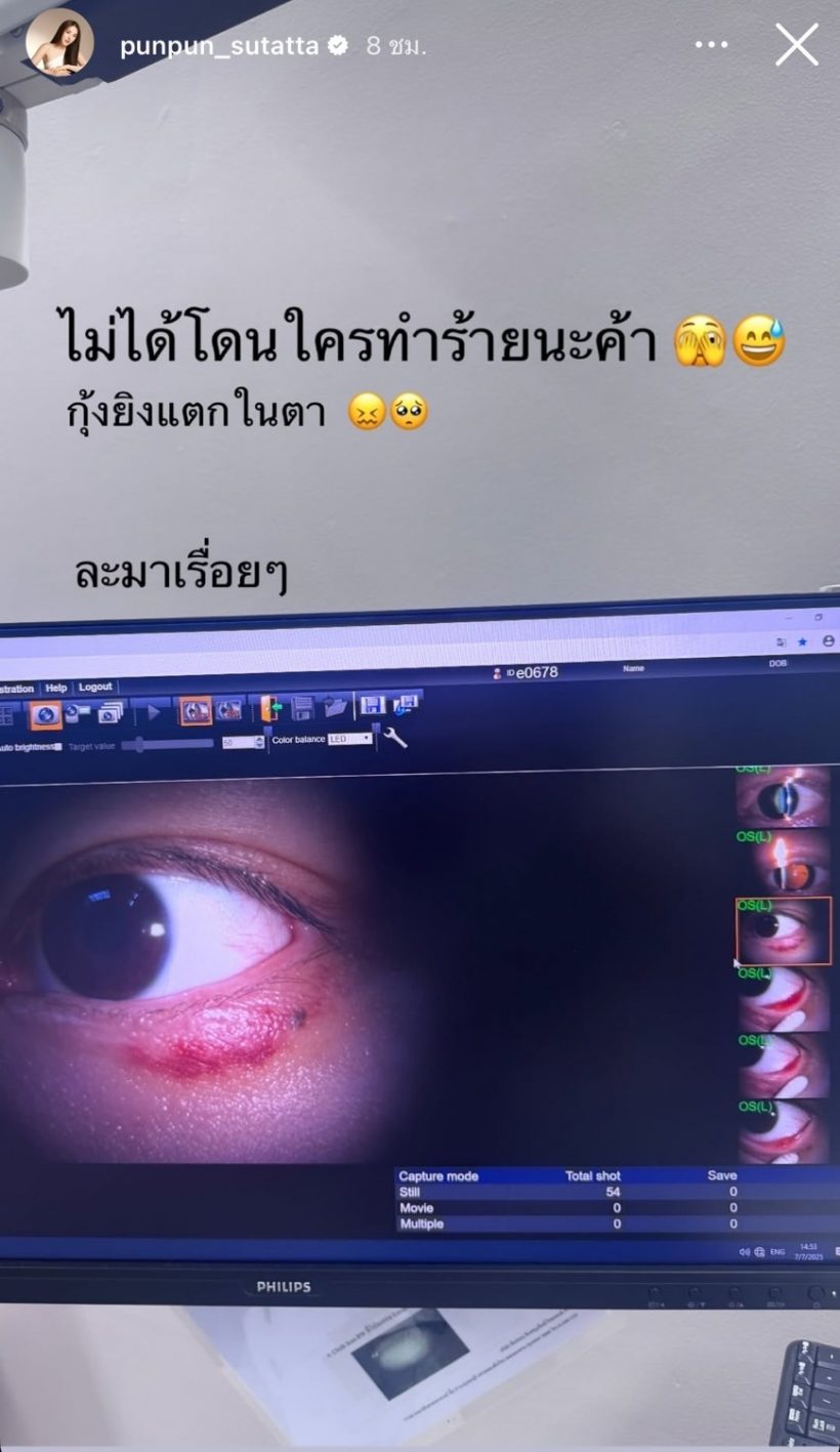 ปันปัน สุทัตตา ตาเป็นอะไร? คนแห่สงสัยโดนทำร้าย!?