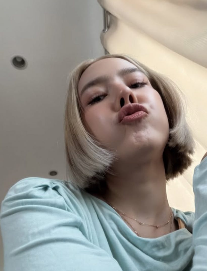 เห็นแล้วเจ็บแทน! ดาราสาวดัง กรามแตก หลังโดนหวดเข้าหน้า