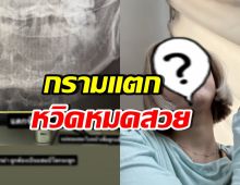เห็นแล้วเจ็บแทน! ดาราสาวดัง กรามแตก หลังโดนหวดเข้าหน้า