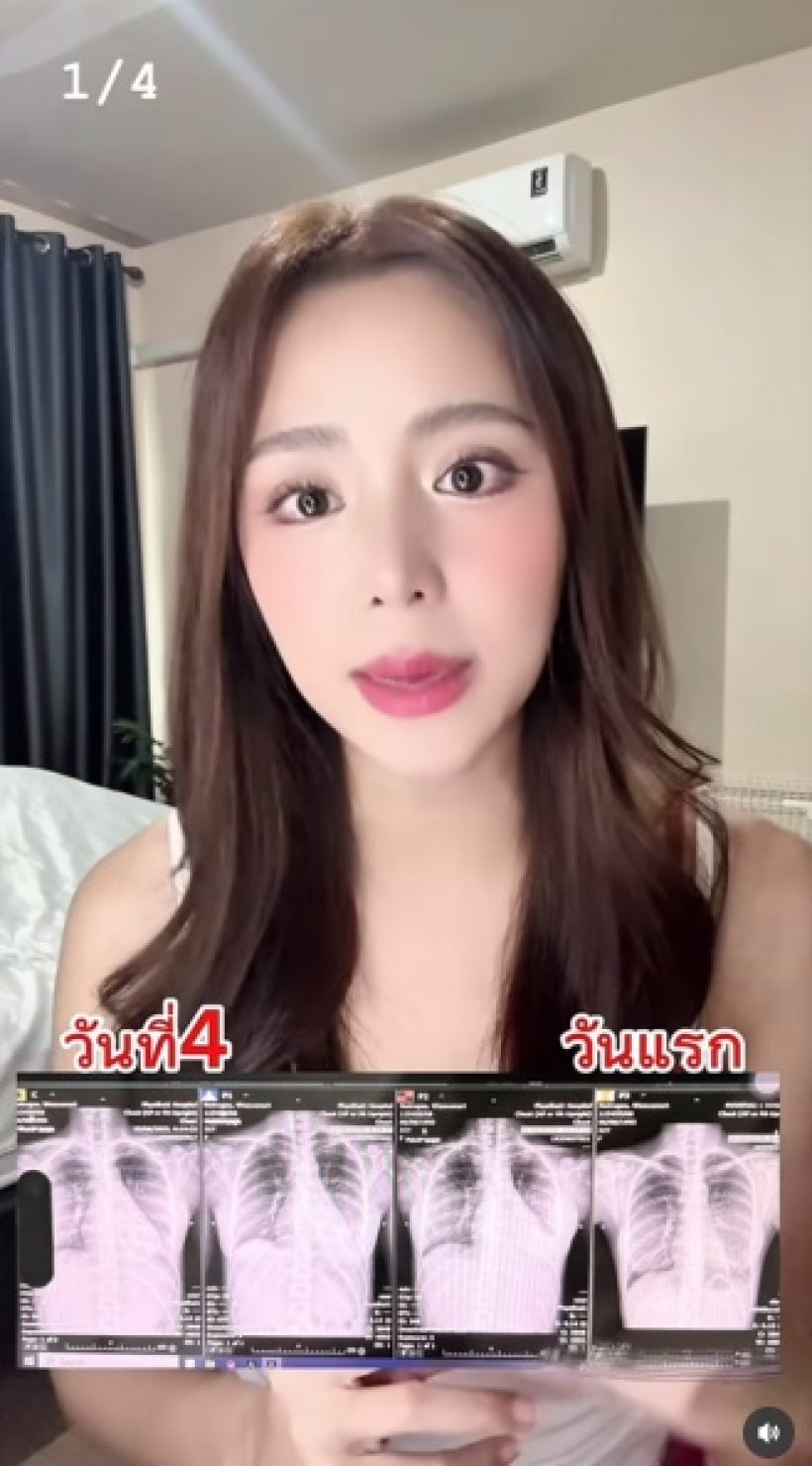 เปิดวินาทีดาราสาวดัง เกิดอาการสโตรก พูดไม่ได้ น่ากลัวมาก