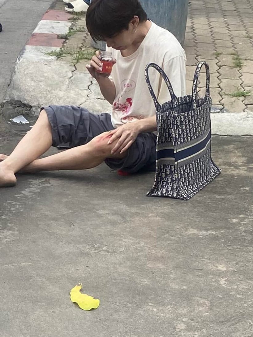ปรบมือให้ เอม วิทวัส เผยสาเหตุไม่ฟ้องใคร หลังประสบอุบัติเหตุ
