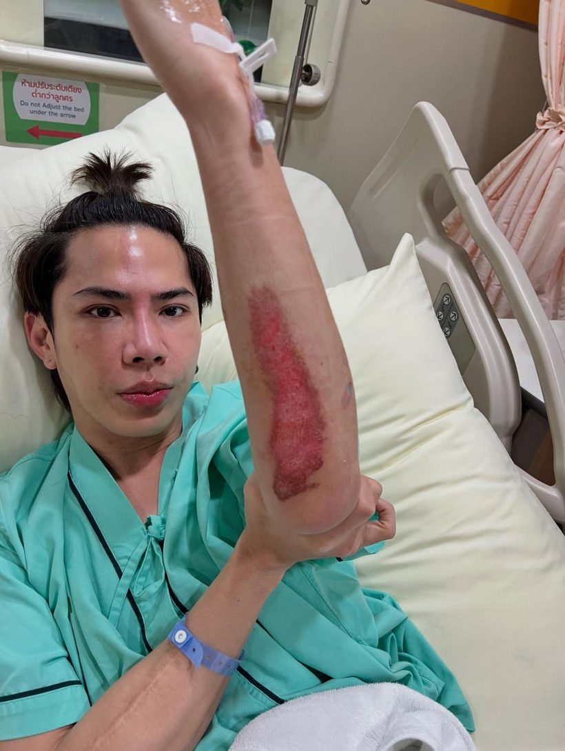 ปรบมือให้ เอม วิทวัส เผยสาเหตุไม่ฟ้องใคร หลังประสบอุบัติเหตุ