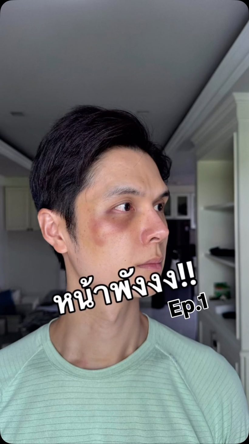 โยชิ ซีควินท์ พลีชีพหน้าพัง เรื่องนี้สอนให้รู้ว่าหมอไม่ได้เก่งทุกคน