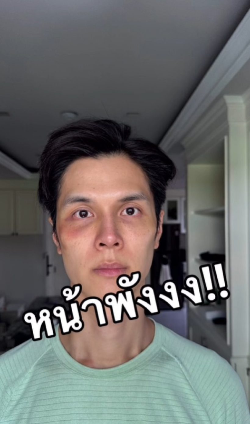 โยชิ ซีควินท์ พลีชีพหน้าพัง เรื่องนี้สอนให้รู้ว่าหมอไม่ได้เก่งทุกคน