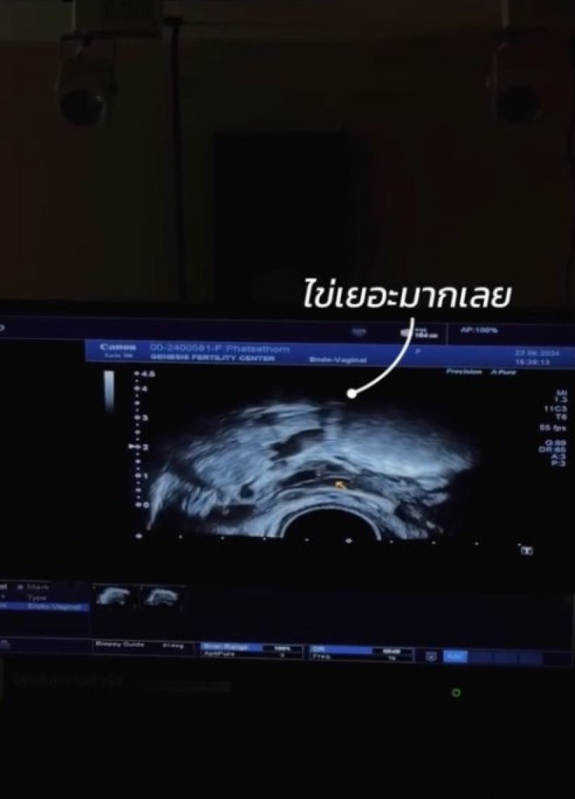 ดาราสาวคนดัง วางแผนเตรียมมีลูก รีวิวฝากไข่ครั้งแรกในวัย 26 ปี