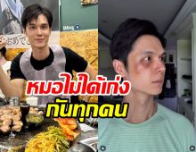 โยชิ ซีควินท์ พลีชีพหน้าพัง เรื่องนี้สอนให้รู้ว่าหมอไม่ได้เก่งทุกคน