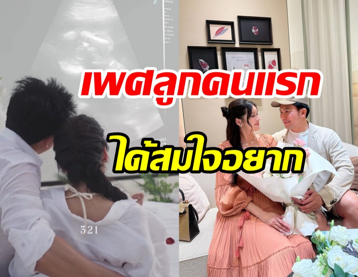 หมอสอง - น้องออน เฉลยเพศลูกคนแรกแล้ว ถูกใจคุณแม่สุดๆ