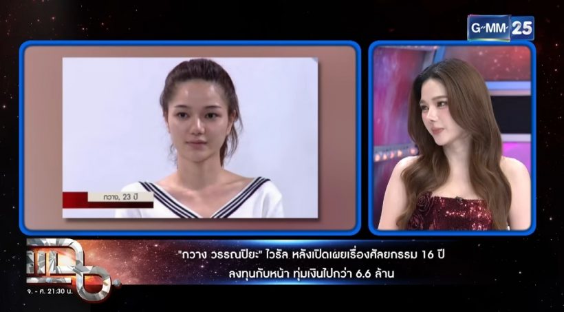 ดาราสาวดัง ยอมรับศัลยกรรมเพราะมีปม ตอนเด็กอ้วน-ไม่สวย