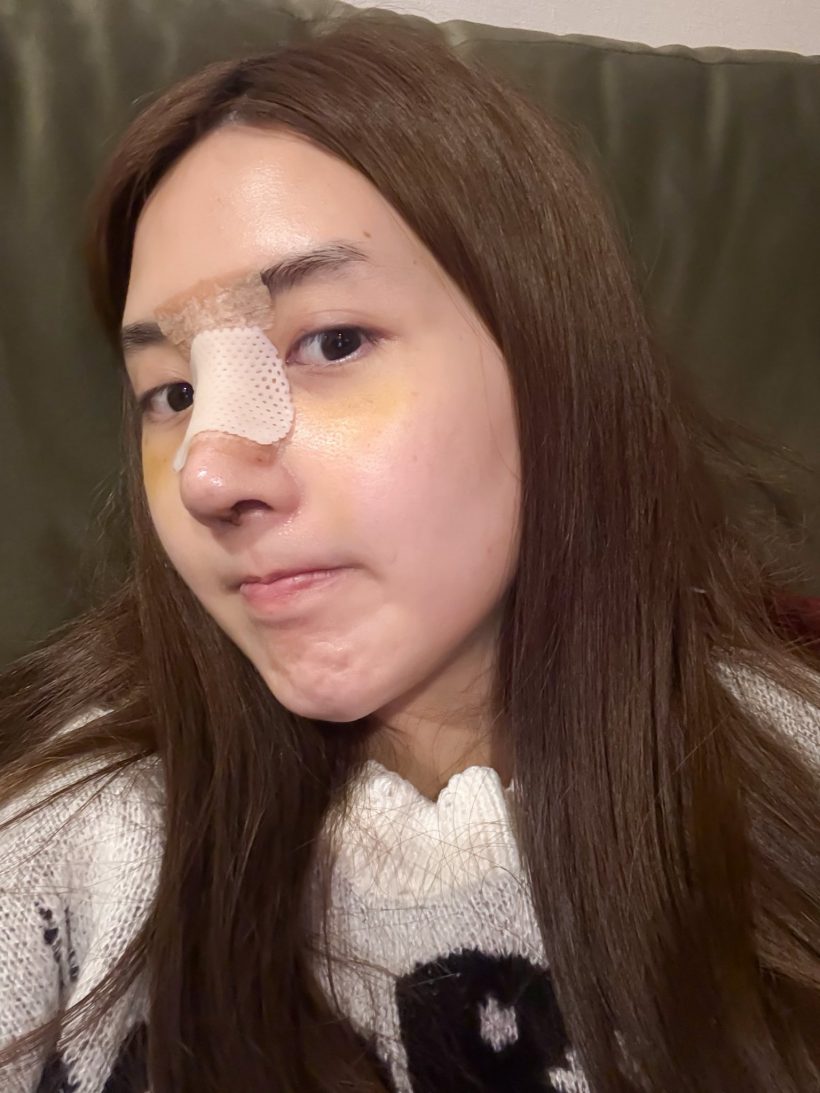 เบียร์ เดอะวอยซ์ ตอกกลับชาวเน็ต หลังถูกแซะแรงเรื่องจมูก