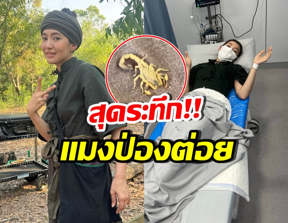 หามด่วน! เบลล่า ราณี เล่าเหตุระทึกแมงป่องต่อยกลางกอง