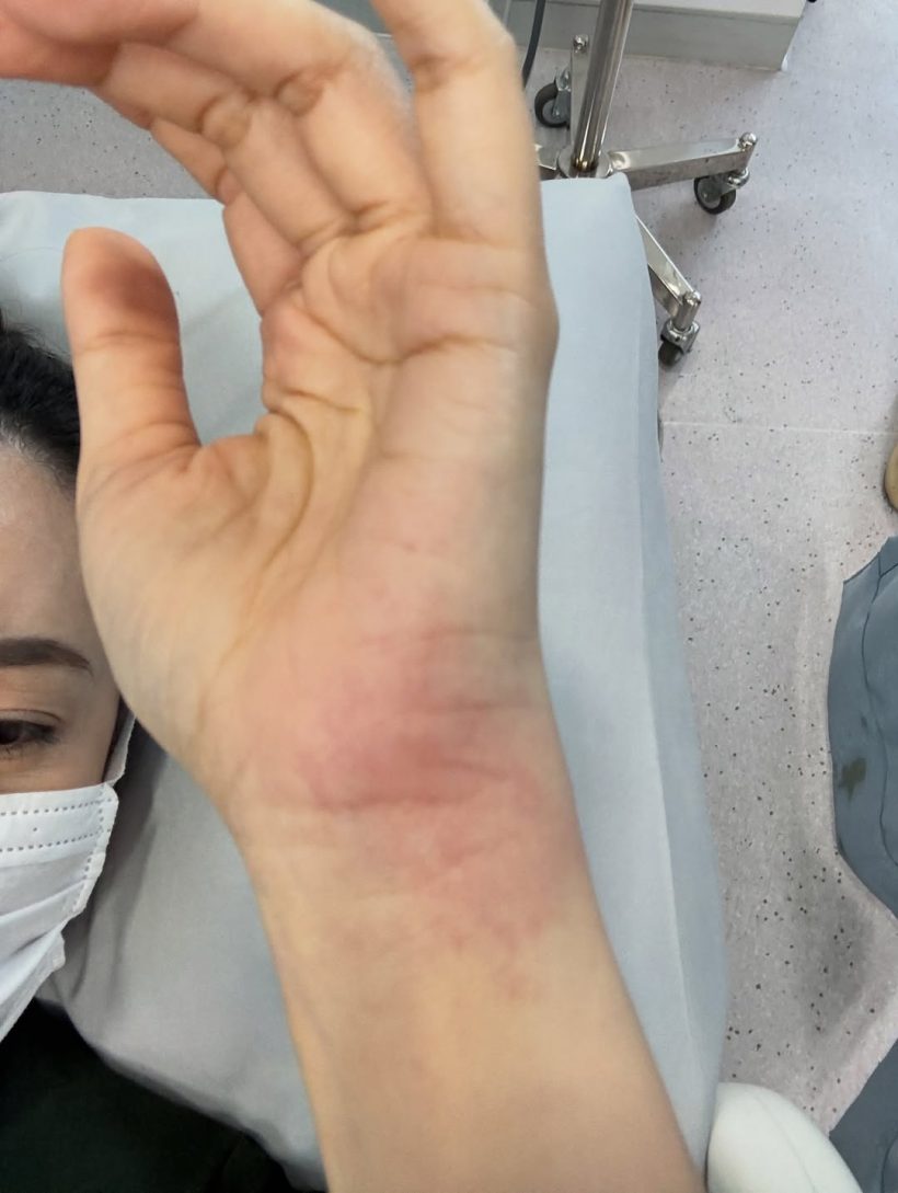 หามด่วน! เบลล่า ราณี เล่าเหตุระทึกแมงป่องต่อยกลางกอง